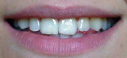 Ok per la legge sull’assistenza odontoiatrica